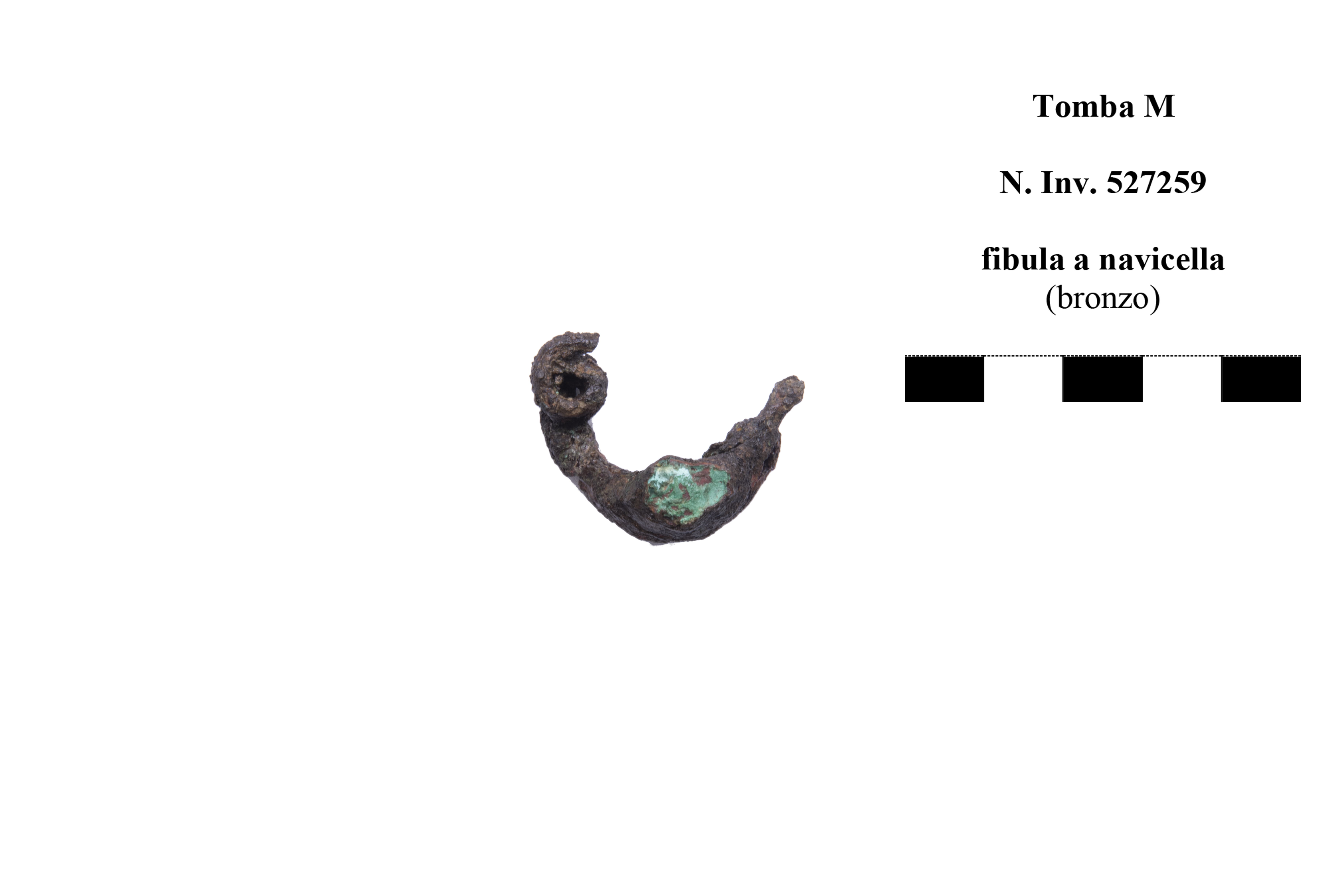 fibula