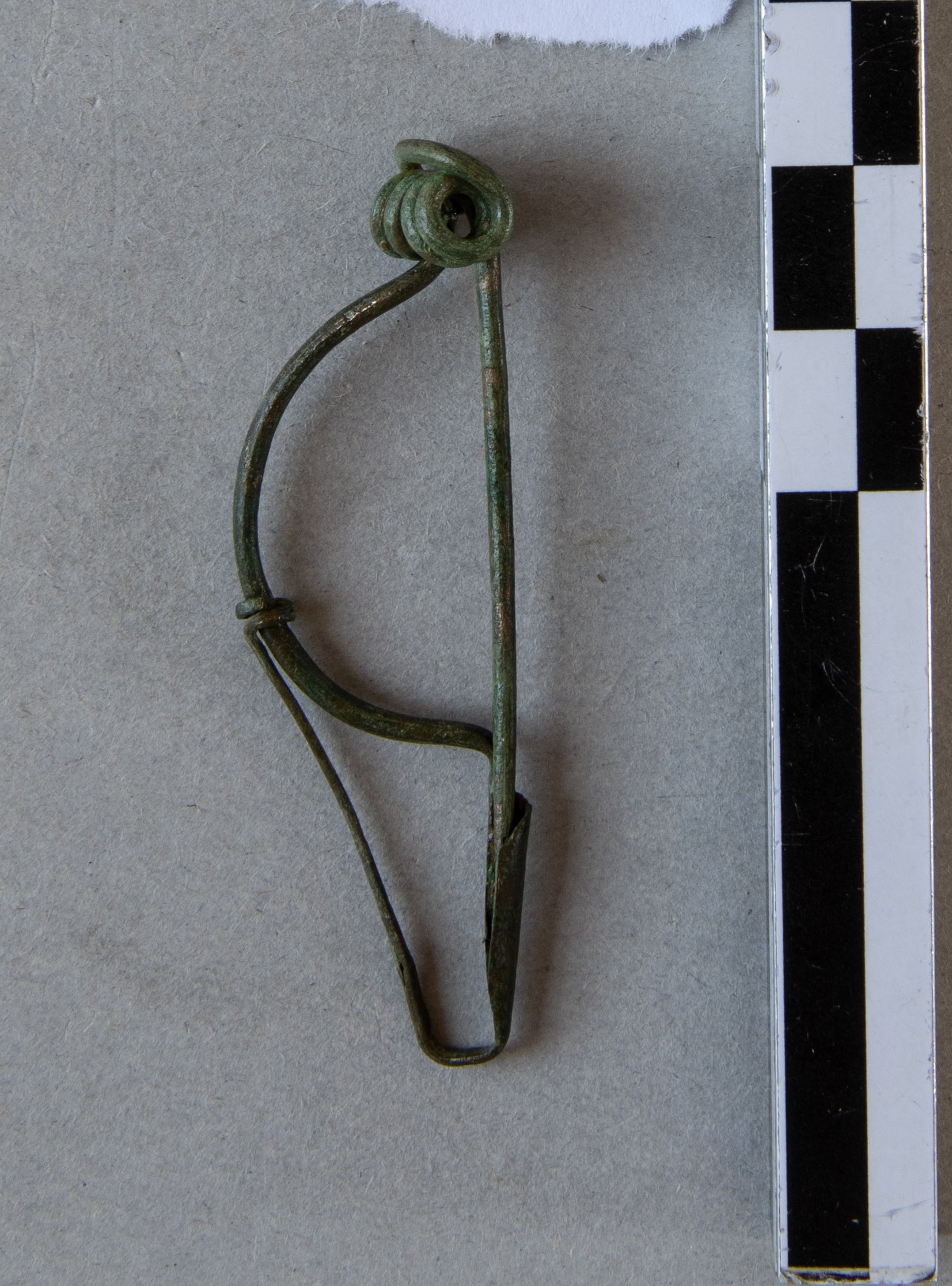 fibula